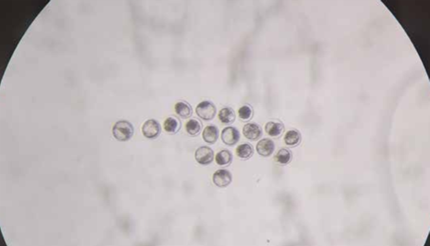 Transplantation Embryonnaire